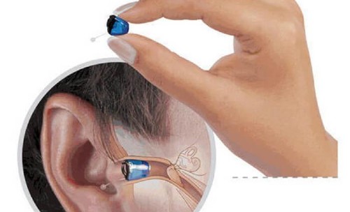 nano plug hearing aid reviews